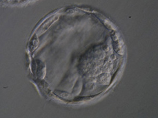 5日目まで培養し発育した胚盤胞