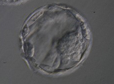 5日目まで培養し発育した胚盤胞